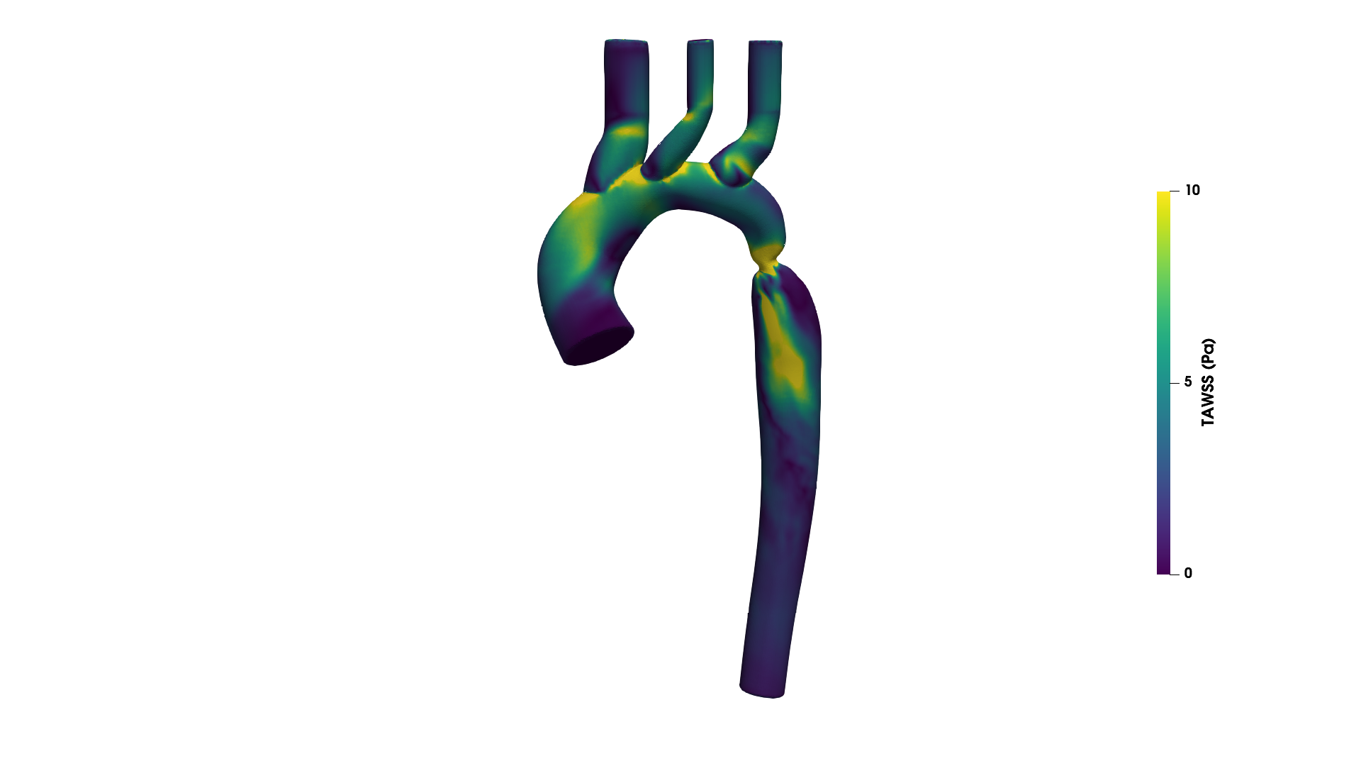 Wall shear stress on G3 aorta